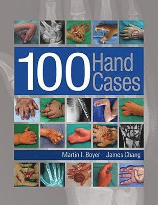 100 Hand Cases 1