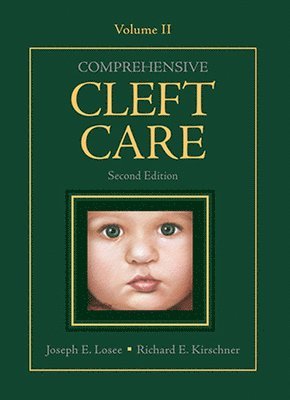 Comprehensive Cleft Care, Second Edition: Volume Two 1