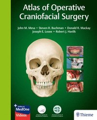 bokomslag Atlas of Operative Craniofacial Surgery
