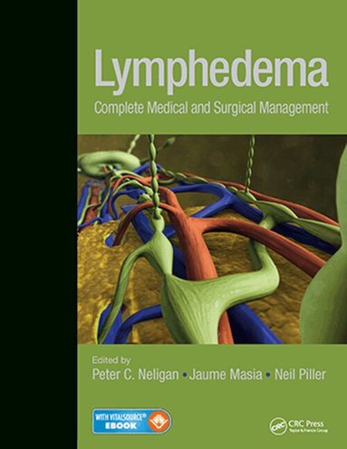 Peter Neligan, Jaume Masia, Neil Piller - Lymphedema, Inbunden
