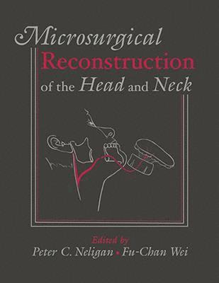 bokomslag Microsurgical Reconstruction of the Head and Neck