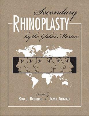 Secondary Rhinoplasty by the Global Masters 1