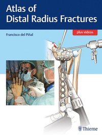 bokomslag Atlas of Distal Radius Fractures