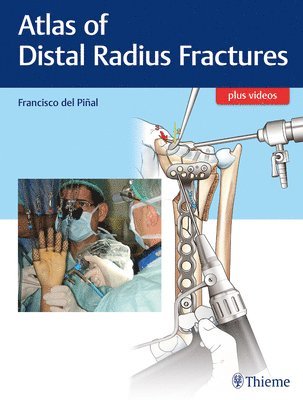 Atlas of Distal Radius Fractures 1