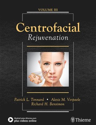 Centrofacial Rejuvenation 1