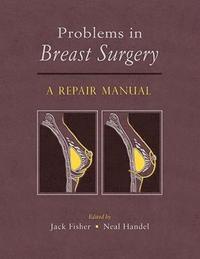 bokomslag Problems in Breast Surgery