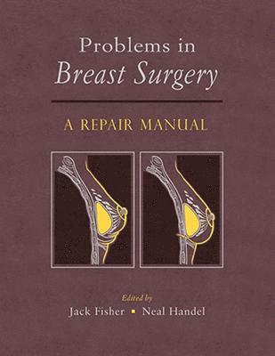 Problems in Breast Surgery 1