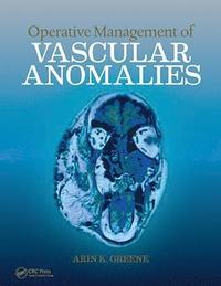 bokomslag Operative Management of Vascular Anomalies