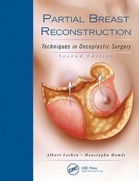 bokomslag Partial Breast Reconstruction