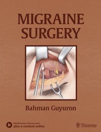 bokomslag Migraine Surgery