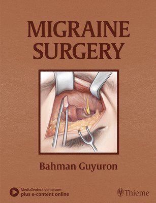 Migraine Surgery 1