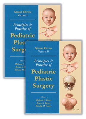 Principles and Practice of Pediatric Plastic Surgery 1