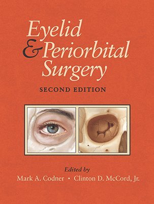 Eyelid and Periorbital Surgery 1