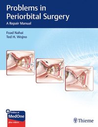 bokomslag Problems in Periorbital Surgery