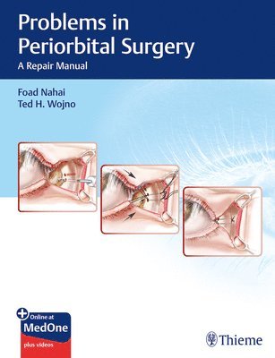 Problems in Periorbital Surgery 1