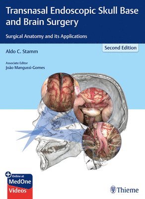 Transnasal Endoscopic Skull Base and Brain Surgery 1
