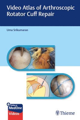 bokomslag Video Atlas of Arthroscopic Rotator Cuff Repair