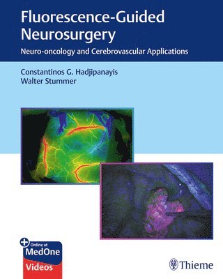 bokomslag Fluorescence-Guided Neurosurgery