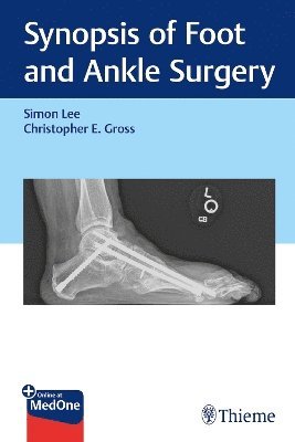 bokomslag Synopsis of Foot and Ankle Surgery