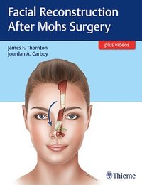 bokomslag Facial Reconstruction After Mohs Surgery