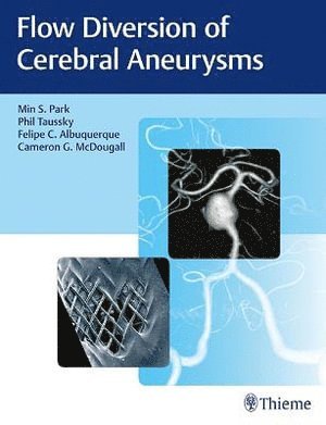 bokomslag Flow Diversion of Cerebral Aneurysms