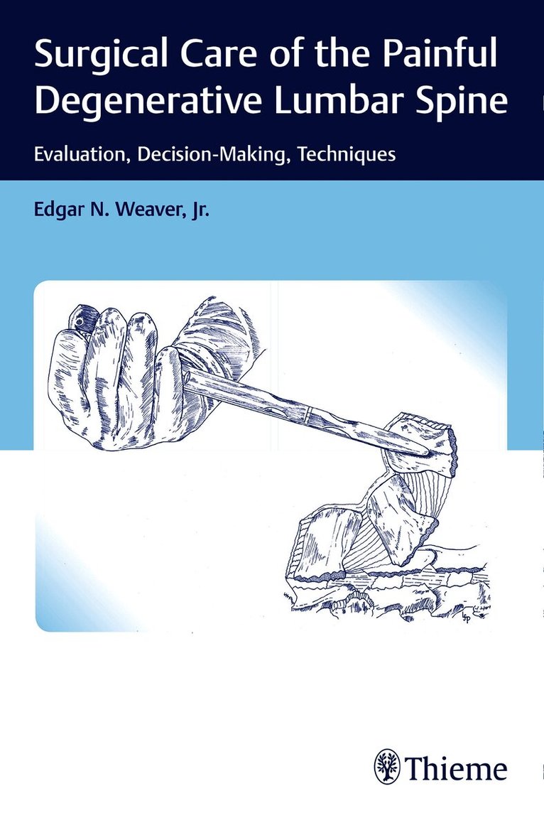 Edgar Weaver - Surgical Care of the Painful Degenerative Lumbar Spine, Häftad