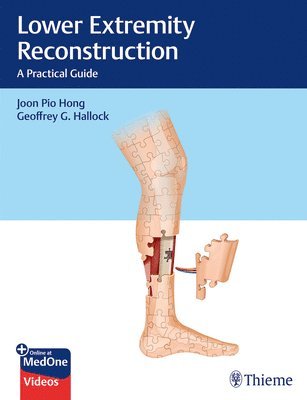 Lower Extremity Reconstruction 1
