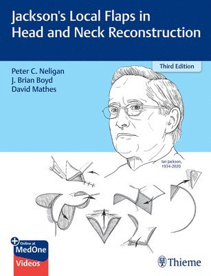 Jackson's Local Flaps in Head and Neck Reconstruction 1