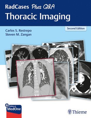 Carlos S. Restrepo, Steven M. Zangan, Carlos S Restrepo, Steven M Zangan - RadCases Plus Q&a Thoracic Imaging, Häftad