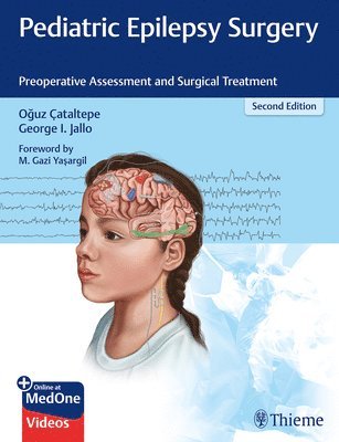 Pediatric Epilepsy Surgery 1