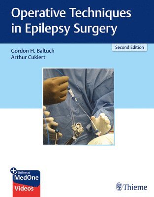 Operative Techniques in Epilepsy Surgery 1