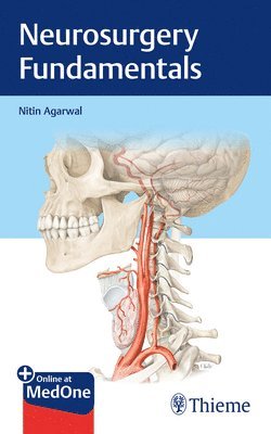 bokomslag Neurosurgery Fundamentals