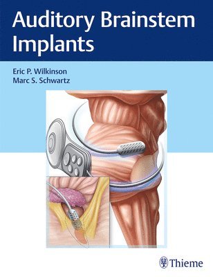 bokomslag Auditory Brainstem Implants