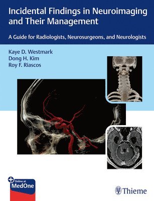 bokomslag Incidental Findings in Neuroimaging and Their Management