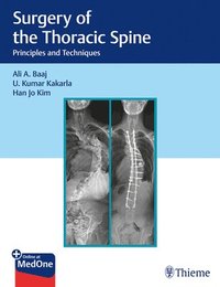 bokomslag Surgery of the Thoracic Spine