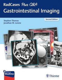 bokomslag RadCases Plus Q&a Gastrointestinal Imaging