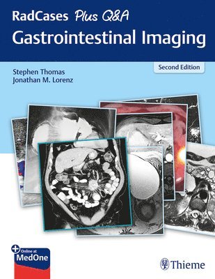 bokomslag RadCases Plus Q&a Gastrointestinal Imaging