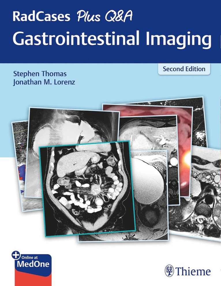 RadCases Plus Q&a Gastrointestinal Imaging