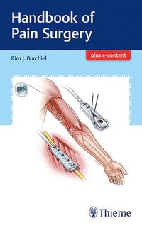 bokomslag Handbook of Pain Surgery