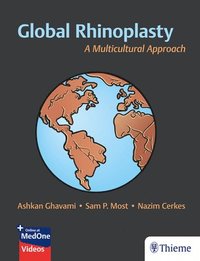 bokomslag Global Rhinoplasty