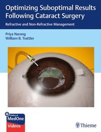 bokomslag Optimizing Suboptimal Results Following Cataract Surgery