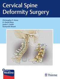 bokomslag Cervical Spine Deformity Surgery
