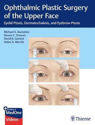 bokomslag Ophthalmic Plastic Surgery of the Upper Face