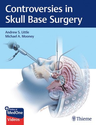 bokomslag Controversies in Skull Base Surgery