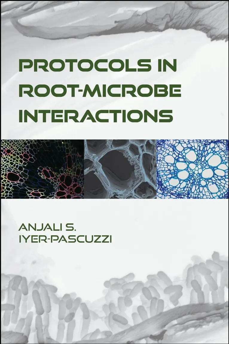 Protocols in Root-Microbe Interactions