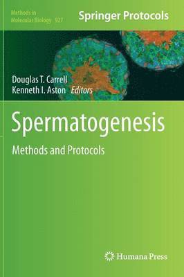 Spermatogenesis 1