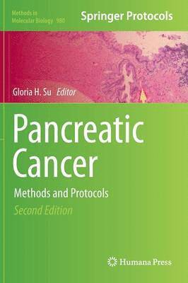 bokomslag Pancreatic Cancer