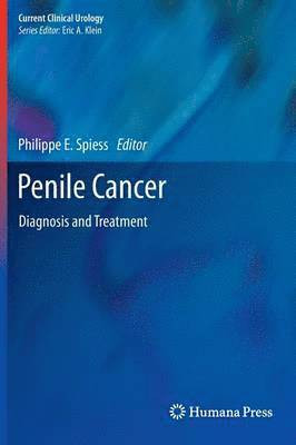 Penile Cancer: Diagnosis and Treatment