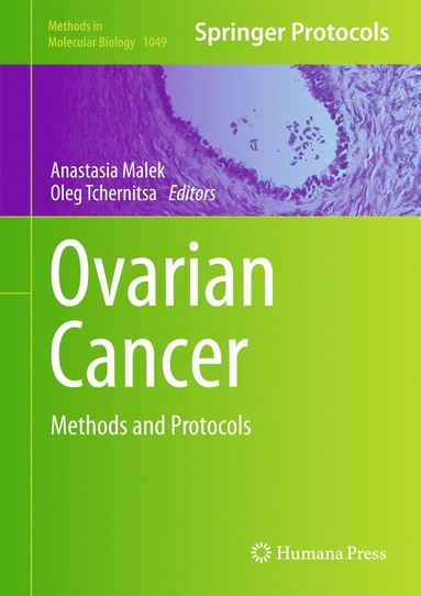 bokomslag Ovarian Cancer