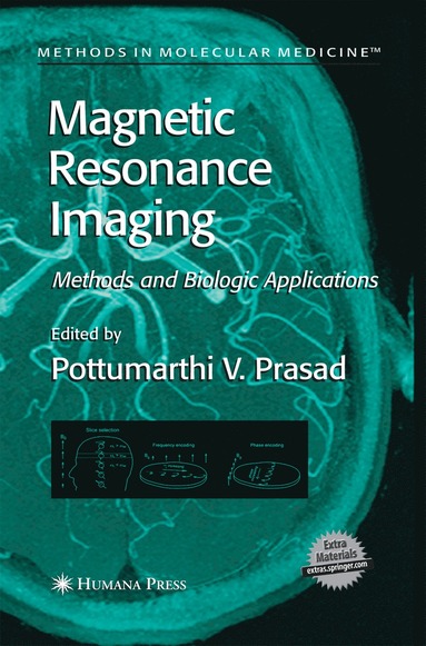 bokomslag Magnetic Resonance Imaging